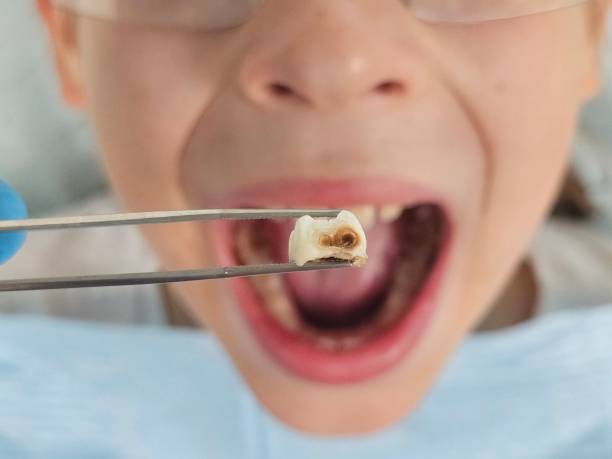 Best Emergency Treatment for Toothache in Slaton, TX